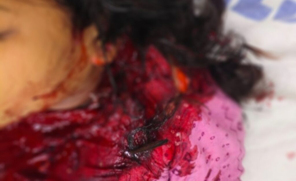 बिलासपुर शहर तीन सगी बहनों पर धार-धार हथियार से जानलेवा हमला एक का हालात गंभीर जांच में जुटी पुलिस।