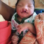 जब चिरायु टीम बनी एक परिवार की उम्मीद, जन्मजात विकृति से जूझ रहे बच्चे को मिला नया जीवन