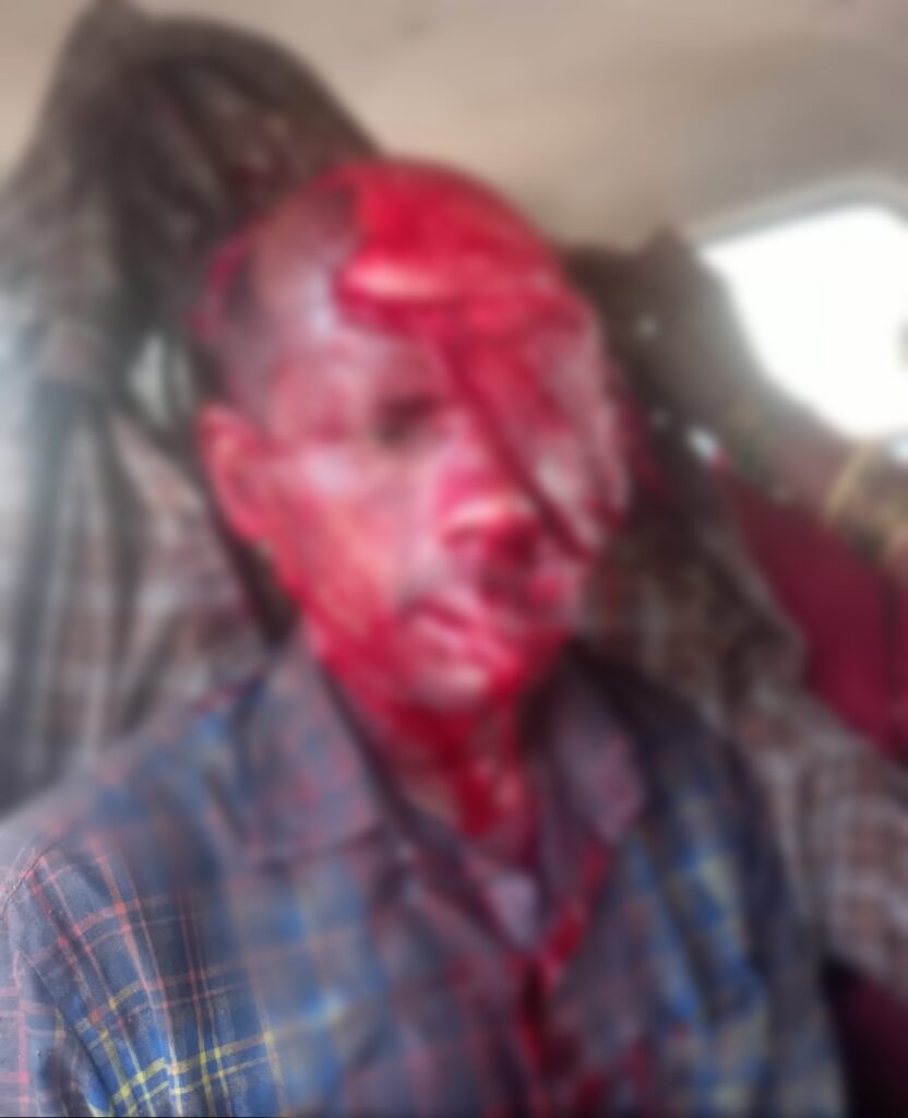 महुआ बीनने गए ग्रामीण पर भालू ने किया हमला, हालत नाजुक, ग्रामीणों में दहशत,