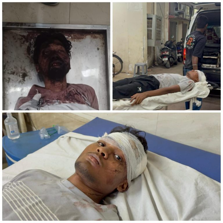झोराघाट पिकनिक से लौट रहे युवकों का ऑटो पलटा, 2 की मौत, कई घायल