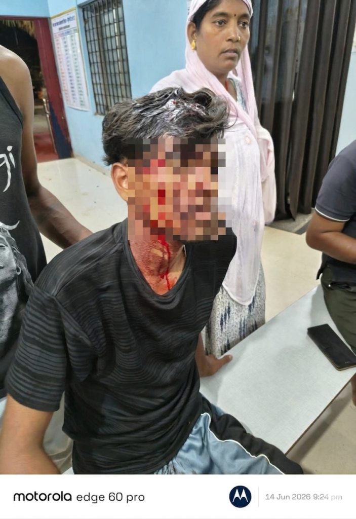नल के पानी को लेकर विवाद के बाद दो पक्षों में मारपीट, निष्पक्ष जांच की मांग तेज पीड़ित पक्ष ने गंभीर आरोप लगाते हुए पुलिस कार्रवाई पर उठाए सवाल
