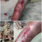 जंगली सुअर के हमले से घायल व्यक्ति की इलाज कराकर मुआवजा दे वन विभाग-युधिष्ठिर नायक
