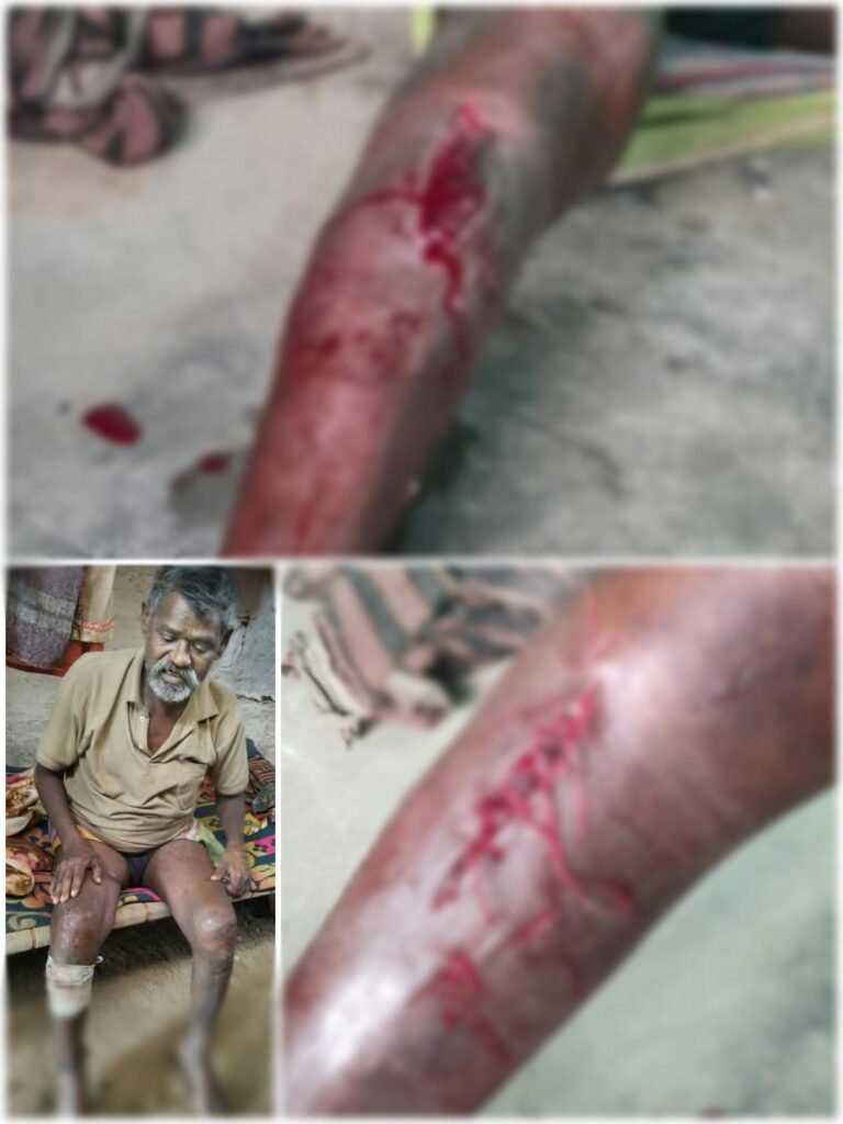 जंगली सुअर के हमले से घायल व्यक्ति की इलाज कराकर मुआवजा दे वन विभाग-युधिष्ठिर नायक
