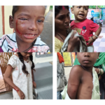 24 घंटे तक तीन गांवों में दहशत; बच्चों समेत 10 लोगों को काटने की जानकारी, एक बच्चे की आंख के पास गंभीर चोट, रायपुर रेफर; 10वें हमले के बाद ग्रामीणों का फूटा गुस्सा