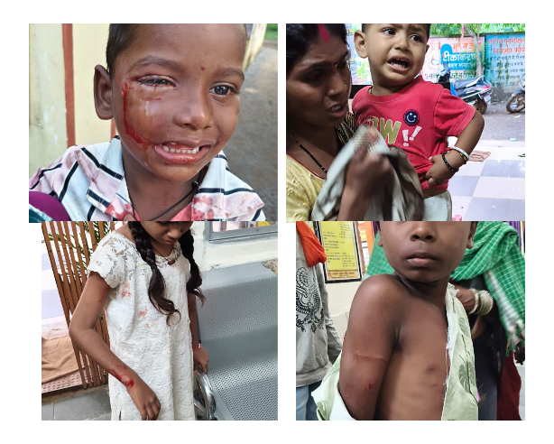 24 घंटे तक तीन गांवों में दहशत; बच्चों समेत 10 लोगों को काटने की जानकारी, एक बच्चे की आंख के पास गंभीर चोट, रायपुर रेफर; 10वें हमले के बाद ग्रामीणों का फूटा गुस्सा